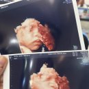 수서나을산부인과의원 이미지