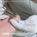 레푸스 수원광교점 | 수원 광교점 레푸스 문제성발 내성발톱교정 후기 정지선 푸스플레게 추천