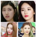 연신내왁싱 체리왁싱 헤어라인왁싱 솔직후기