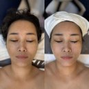 FORME:포미 | [풍암동피부관리] 정성 가득한 맞춤 윤곽관리 포미뷰티 방문 후기