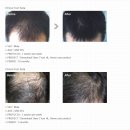 에이치엘HAIR 네이버블로그