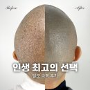 다연티아카데미 | 안양두피문신, 인생 최고의 선택 (후기)