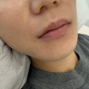 위니드뷰티 네이버블로그