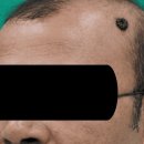 봄철 나의 두피 및 피부관리법 이미지