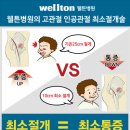 고관절통증 일으키는 대퇴골두무혈성괴사. 수술 해야할까요? 고관절인공관절의 수술방법, 수술비용 이미지