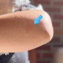 엠디그린피부과의원 | 재생크림 추천, 동국제약 마데카 엠디 MD크림 피부과 제품 사용 후기