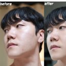 피지업 | 얼굴 피지 제거 방법 여드름 피부 관리 피지웰 맨 글로우 업 사용후기