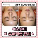 레티나메디칼 | 청주피부관리전문 "예소뷰티"에서 슈퍼젝션관리 후기