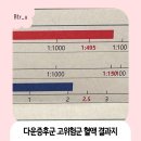 양수2 | 다운증후군 고위험군 양수검사 후기 2차 기형아검사(쿼드)