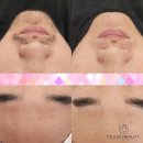 뷰티문(Beauty moon) 이미지