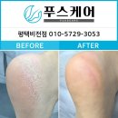 주차관리과 | 겨울철 건조한 발, 평택발관리 푸스케어에서 독일식발관리받은 후기