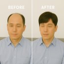 천안가발 50대남의 변신이야기(휴먼가발)