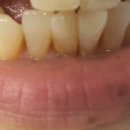 이가의안클린 이미지