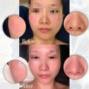 지흡바본관리와 피부관리, 두피케어 관리까지 [안산 중앙동 라비에에스테틱]