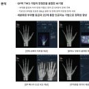 잠실삼성365의원 네이버블로그