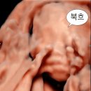 (주)토옥 | 임신일기 - 21주/22주/23주/24주차 일기 정밀초음파/임당검사/임신성빈혈