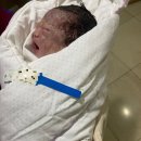 남산(1,2,3통)할머니 경로당 | 둘째 출산 제왕절개 수술 1,2일차(리앤아이 산부인과)
