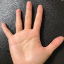 [손금 해석 / 애정운] 비애선(悲哀線)의 원인 ! 가늘어진 약지와 넓은 간격 독립형 두뇌선 이미지