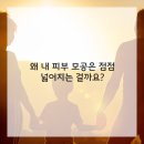 브이의원 네이버블로그