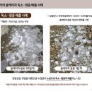 미라클케어 이미지
