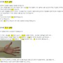 산행 중 다리에 쥐가 났을 때의 응급조치법 이미지