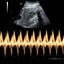 아바타소프트(주) | 12월 3주 4주 5주 감기 이슈로 몰아쓰는 일상 기록