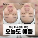 예쁨 | 다산 피부관리 추천, 홍조·예민피부 진정에 진짜 좋았던 오늘도예쁨 후기