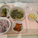 안와종양 유피낭종 수술 4년 후 후기 / 삼성서울병원 안과 안성형 우경인 교수님