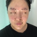 울산 남구 만족도 높은 피부관리샵 더고운테라피 리프팅관리 받고온 후기
