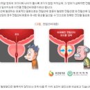 드림온비뇨기과 네이버블로그