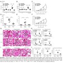 엔에프바이오 | 컴파운드케이 기능성 편 (IgA 신증 치료 효과)