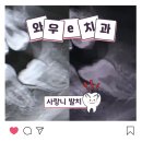 E-믿음치과의원 | 신경 마비 0.5% 확률, 매복 사랑니🦷 5년 고민 끝에 발치 성공, 와우e치과