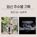 11545-10-14-12 | 임신 주수별 기록 12~14주 차 / 1차 기형아검사 / 목투명대 / 성별 예측 / 14주 배크기
