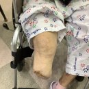 첨단의지제작소 | 오토복 에반토발로 신규 종아리의족을 제작하다