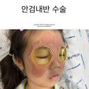 건양어린이집 | 유아 안검내반 수술 세종충남대병원 상담후기 및 경과