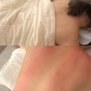 지안 에스테틱 | 부산 해운대 지안에스테틱 등관리 대만족 후기