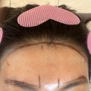 홍 헤어라인 이미지