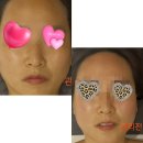 골드PC | 광주 상무지구피부관리 아름다운 골드페이스라인 끌리메 상무점 후기