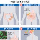 스트레스성 복통 복통 원인 이미지