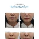 리프업의원 이미지