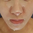 새솔동 피부관리 쁘띠인샵 노블젝션 (귀족리프팅) 후기
