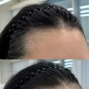 다온뷰티헤어 | 강남 역삼역 다온뷰티 자연스러운 헤어라인 반영구 문신 절대 후회없는 내돈내산 후기