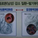 하나열쇠 이미지