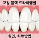 안산마인드치과교정과의원 네이버블로그
