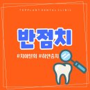 탑플란트치과 이미지