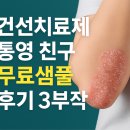 통영약국 | 건선치료제 무료샘플 사용한 통영건선 친구 후기