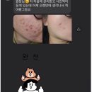 김주희 피부관리