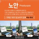 최고안과의원 네이버블로그