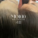 레인솔루션 | 내 머리카락에 찾아온 놀라운 변화, 인천탈모관리 '설레인라인' 방문 후기