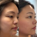 피부이야기 | 대전신부관리로 유명한 오류동 피부이야기 윤곽관리 후기